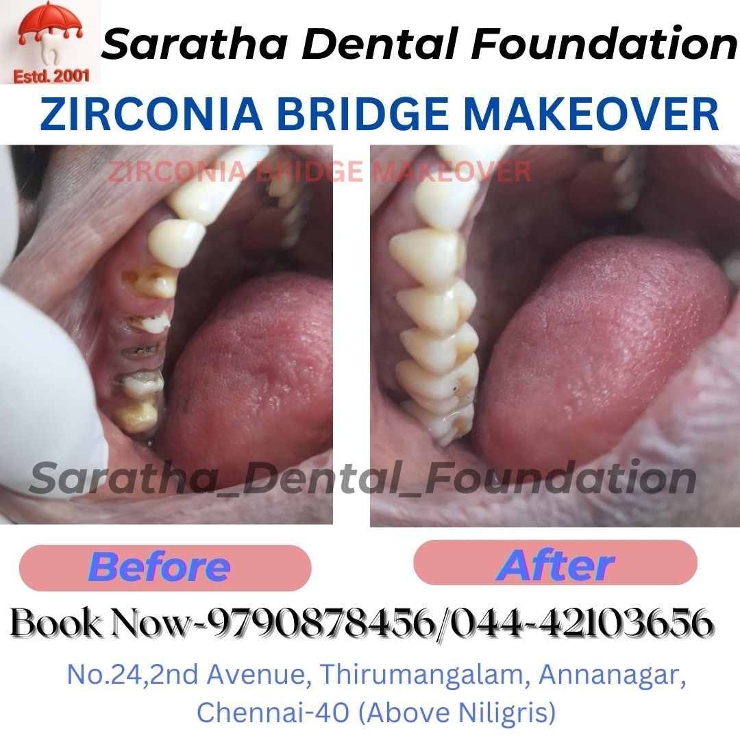 sarathadental