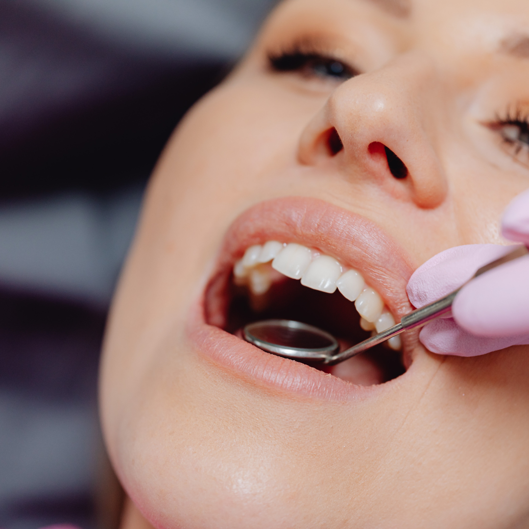 full mouth rehabilitation in anna nagar