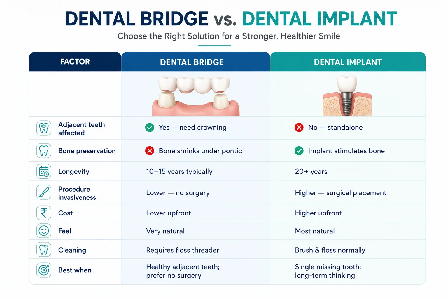 Crown or Bridge vs. Dental Implant