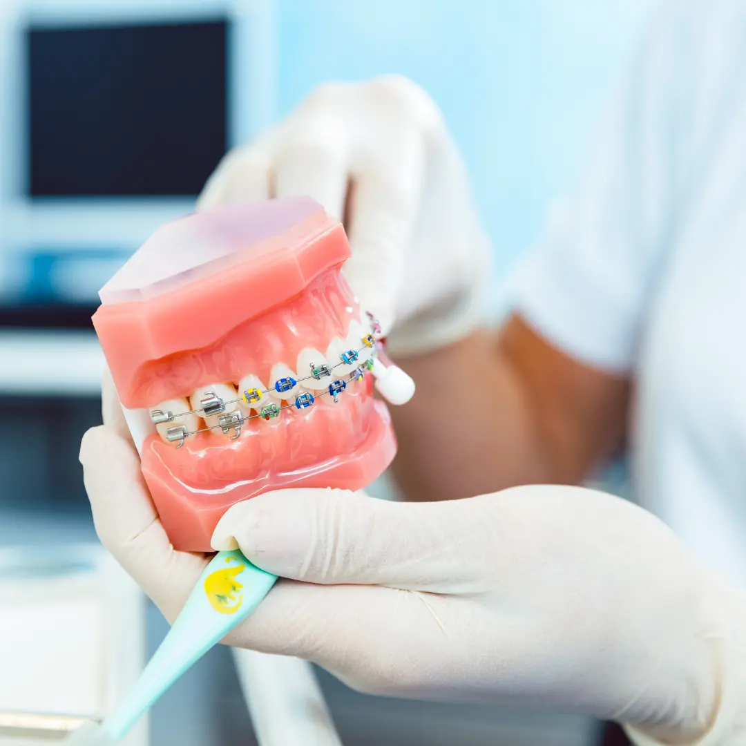 Teeth braces in anna nagar